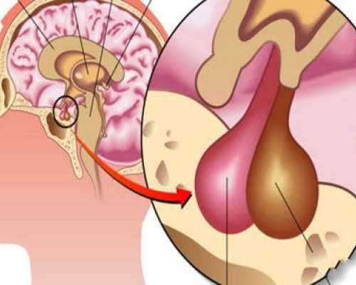 如何判断姨妈血和早孕血区别？专家告诉你