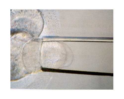 北京供卵机构靠谱,北京三代试管医院,北京哪些医院可以做三代试管