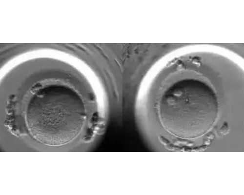 北京代怀助孕服务,北京朝阳医院