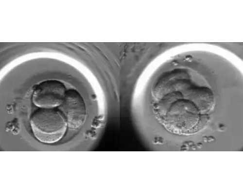 北京私人代怀孕网,北京妇产医院建档,北京妇产医院最强建档攻略
