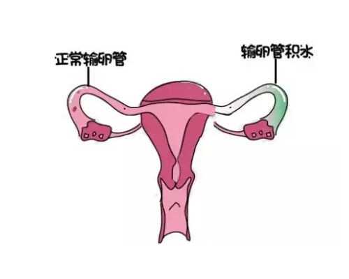 揭秘孕妇容易出现顺转剖原因，概率真没想象中高