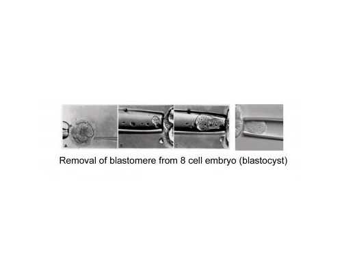 北京哪里找代生,北京家圆医院简介,请问北京家圆医院简介