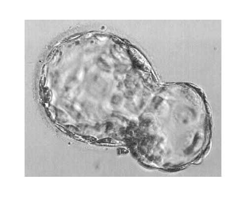 北京有代生妈妈吗,北京供卵不排队医院电话，北京供卵生殖医院