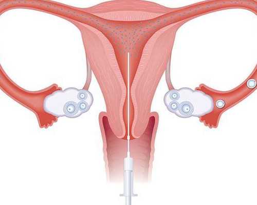 北京代怀中介网,北京精子库网站,北京人类精子库