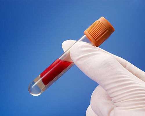 北京哪做代怀好,北京精子库收精子吗,北京有精子库吗