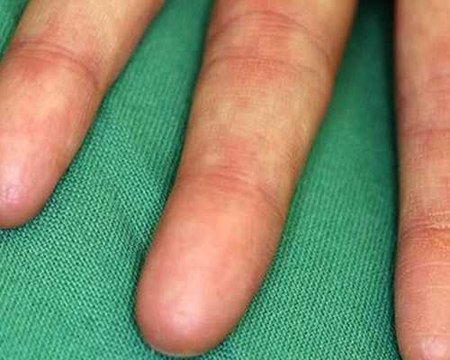 北京供卵成功经验,北京蜂王精价格,北京蜂王精适合什么人喝