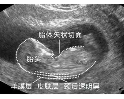北京有代怀价格,北京家圆医院地址在哪,北京天伦医院