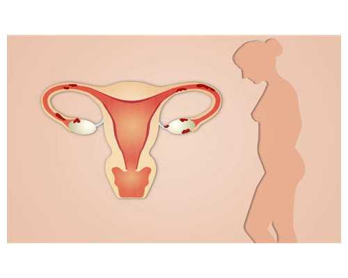 北京试管代生,北京生二胎有补贴吗？2026北京二胎政策最新消息！