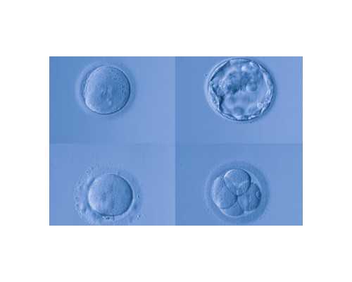 划重点,要想乌克兰试管婴儿成功率高这3大条件必不可少!