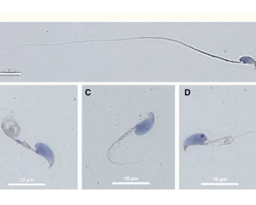 北京靠谱代孕机构,北京捐卵博诺供卵，北京正规捐卵