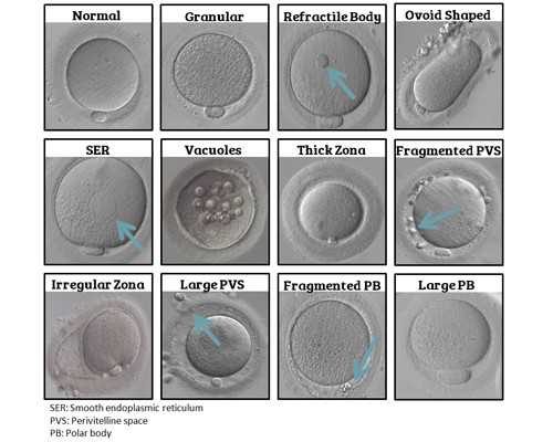 湘雅附一附二附三医院擅长科室公布，看完就知道哪个好！