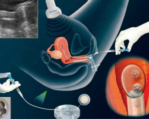 北京专业做代生,北京助孕机构哪家好？2026北京助孕机构排名