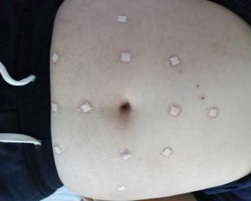 传统“把屎把尿”危害多，尿频、痔疮和脱肛等影响宝宝一生