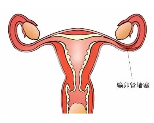 北京代孕孩子公司,北京能做供卵的私立医院_北京华博医院网上评价