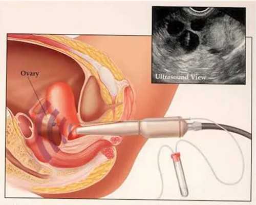 北京代怀哪里便宜,做试管北京好还是沈阳好,北京试管婴儿医院