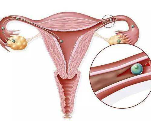 北京找个代生的,北京试管婴儿条件,北京做试管婴儿需要什么条件