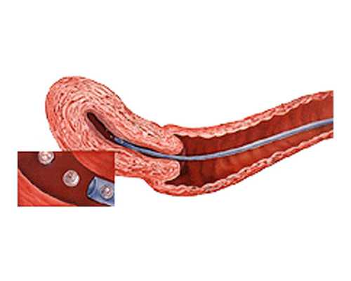 长春三代试管婴儿做一对龙凤胎费用是多少钱？5万够吗？