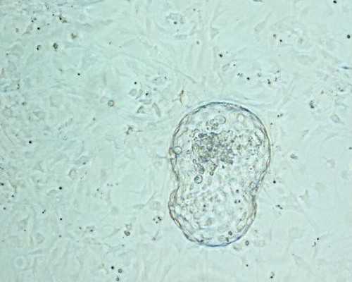 2026江西试管婴儿无子宫选性别十万够吗？附试管医院排名？