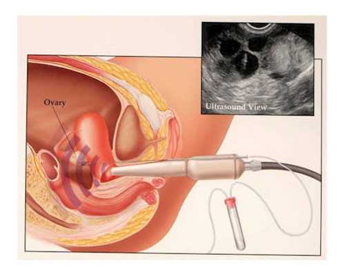 北京试管代生哪最好,北京哪些医院有精子库,北京哪家医院有精子库