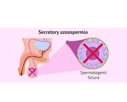 北京知名代孕公司,北京朝阳医院精子库,北京朝阳医院生殖医学中心