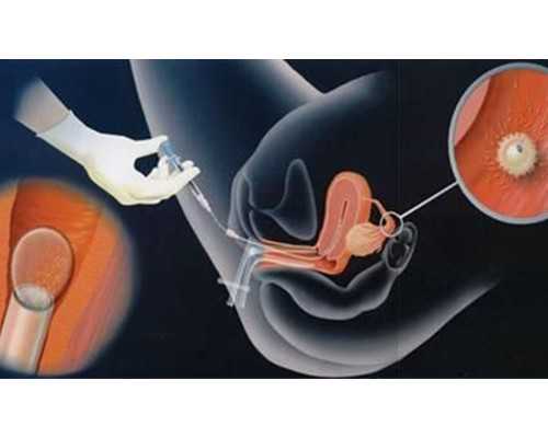 北京供卵女孩照片,北京失独家庭补助标准2026北京失独家庭补助政策