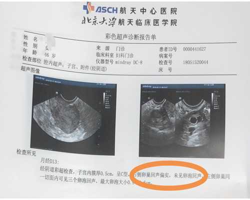 北京代怀孕网微信,北京协和供卵试管婴儿,北京协和试管婴儿经历