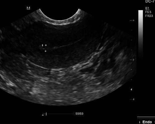 北京有去试管代怀,北京爱心供卵电话,北京供卵平台