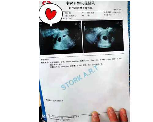 北京代生儿子价格,北京精子库合作的医院,北京哪家医院有精子库