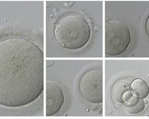 北京代孕网包生男孩,北京试管婴儿十大医院排名哪家北京医院最好