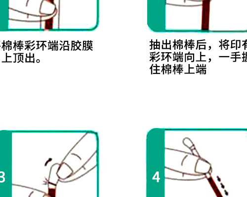 北京供卵代生技术,北京朝阳医院试管婴儿建档需要什么材料