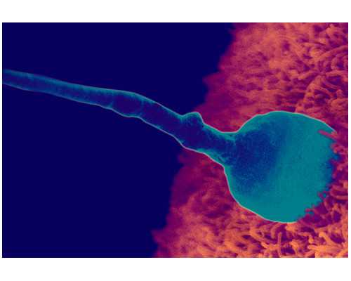 北京试管代怀排行,北京人类精子库咨询电话,北京人类精子库给钱