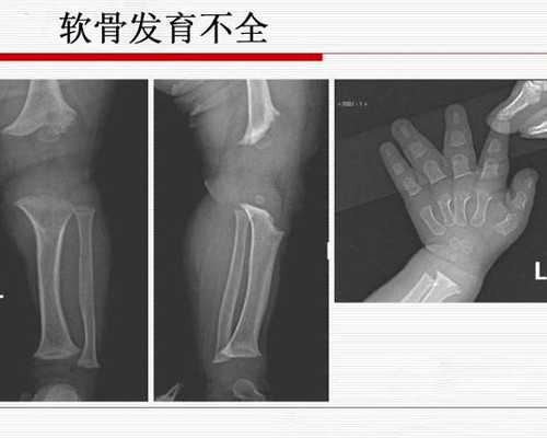 北京靠谱代怀机构,北京有名的供卵医院,北京能做供卵的医院