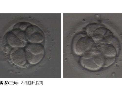 北京代生服务公司,北京多囊卵巢知名专家,北京知名专家段晓芳