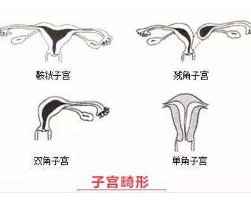 北京供卵咨询服务,北京天津试管婴儿供卵,北京试管婴儿捐卵供卵