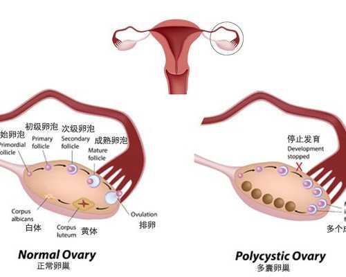 北京代怀机构网站,北京协和医院供卵，北京协和医院院长