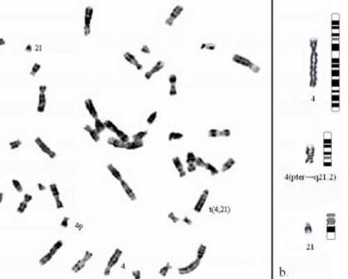 亳州人民医院试管婴儿费用参考，2026单周期收费标准