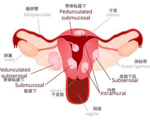 2026内蒙古试管婴儿费用计算，8家医院支出差别不大