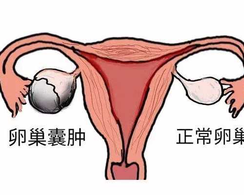 北京专业代生公司,北京哪里单身女可以做冻卵,北京单身女子冻卵
