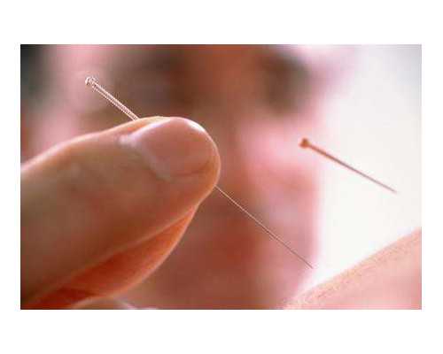 nt值看男女85%的准确率？nt值如何判断生男生女？