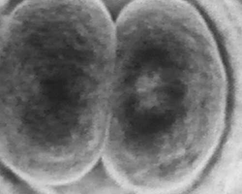 北京代怀手术费用,北京试管婴儿权威医院,北京试管医院