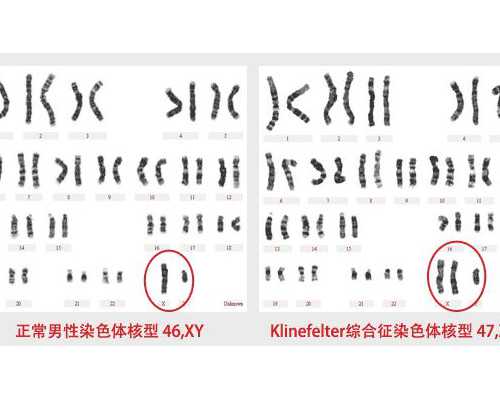 盘点宫腔粘连术后十大禁忌！不能碰的食物掌握清楚恢复快