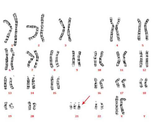 北京代生付费方式,北京家恩德运供卵，第一次到北京家恩德运医院