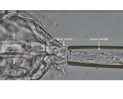 2026信阳能做借卵试管选性别的医院排名？附详细医院介绍？