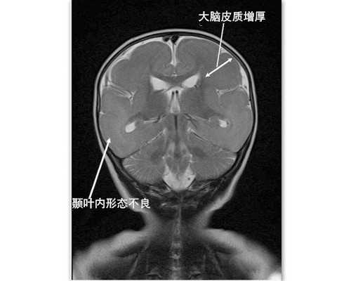北京供卵机构公司,北京美中宜和医院官网,北京美中宜和妇儿医院